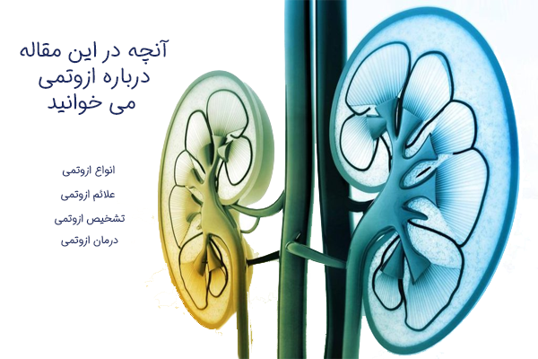 ازوتمی