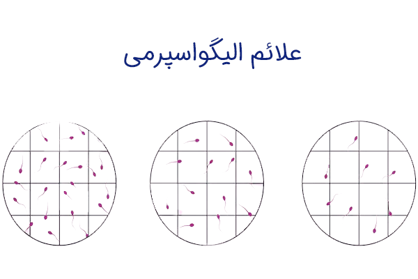 علائم الیگواسپرمی