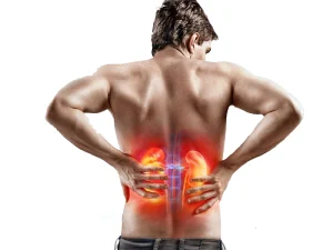 هیدرونفروز کلیه